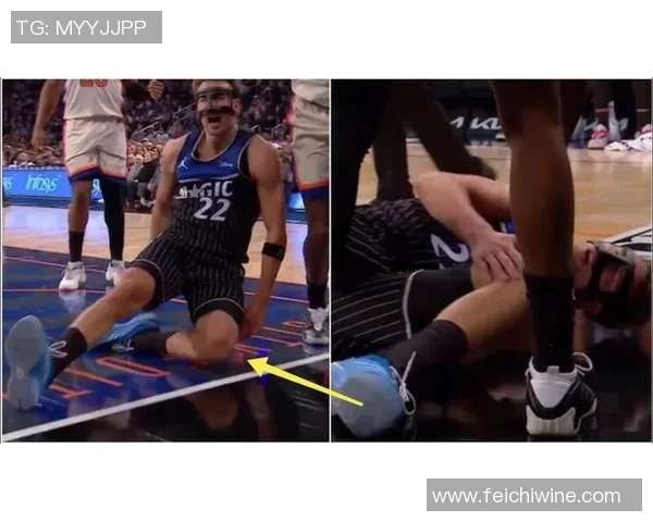 魔术：瓦格纳将接受核磁共振检查，主帅祈祷他伤无大碍